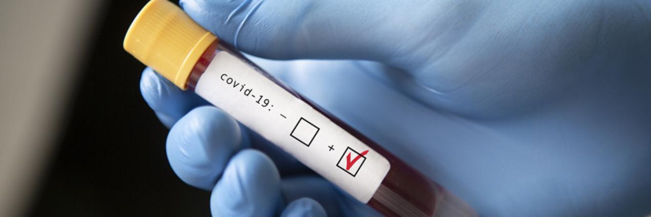 PCR machine - coronavirus test - SCK CEN x Taskforce (2020)