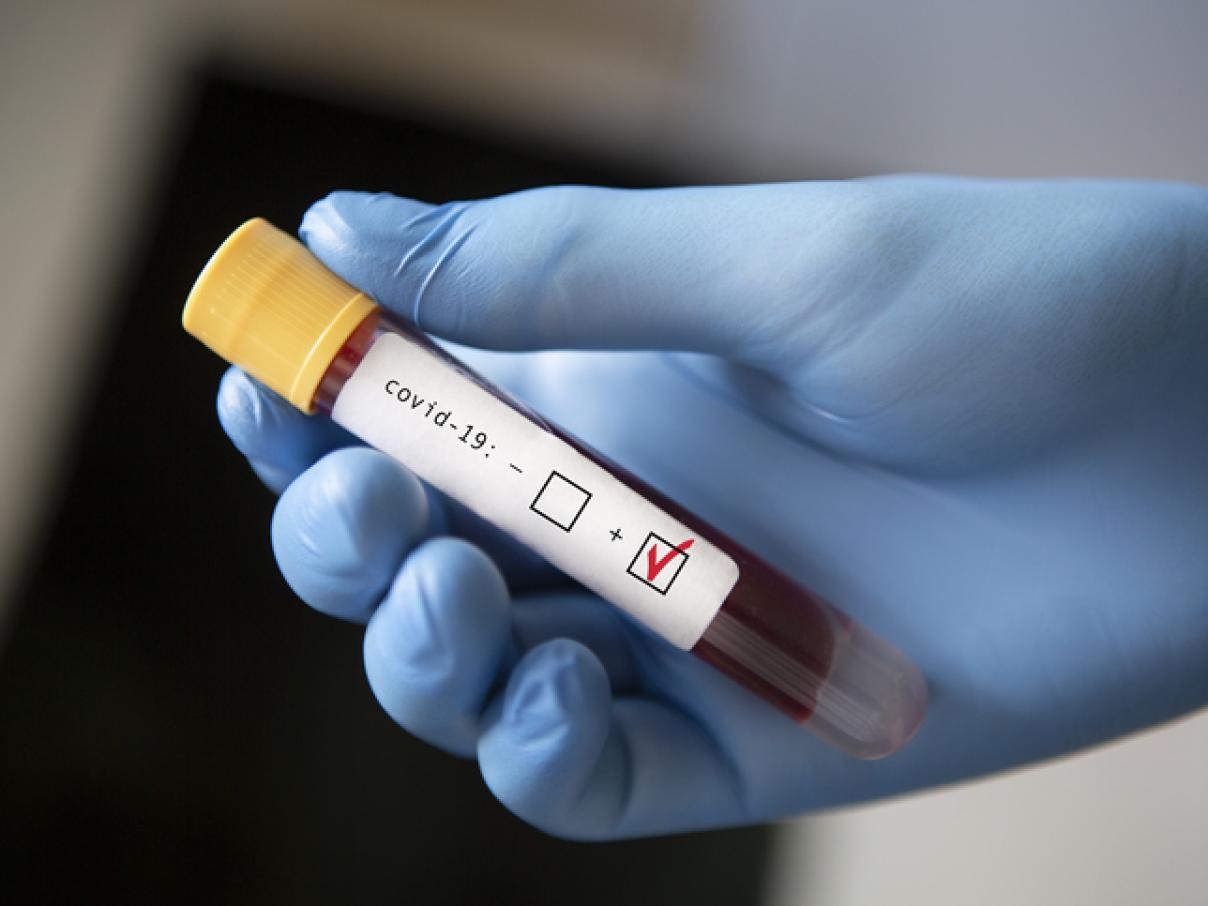 PCR machine - coronavirus test - SCK CEN x Taskforce (2020)